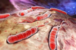 Cholera